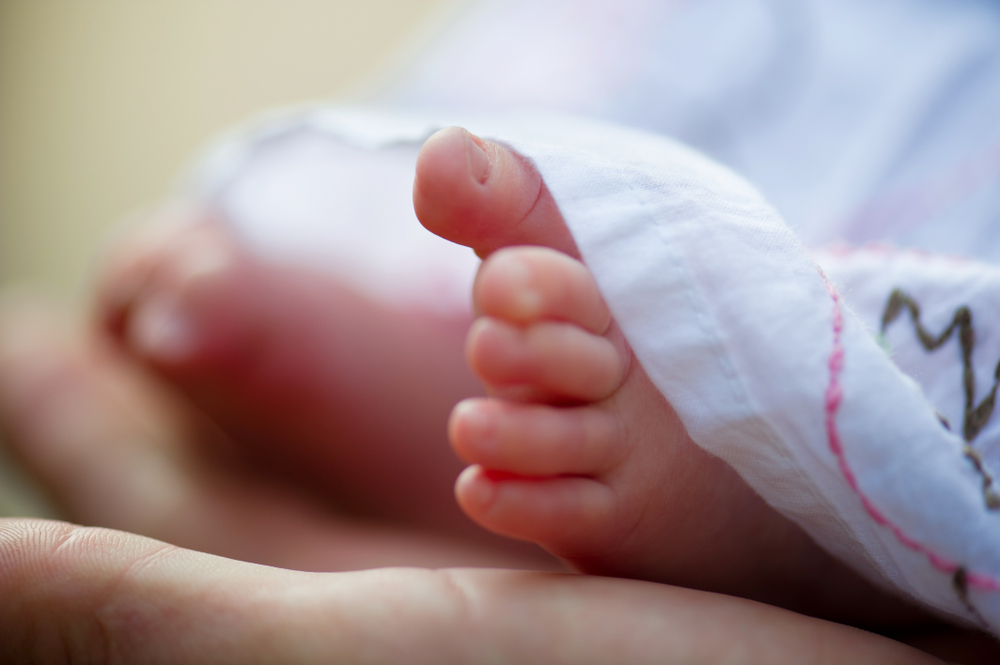 Newborn baby feet after cerebral palsy diagnosis and birth injury