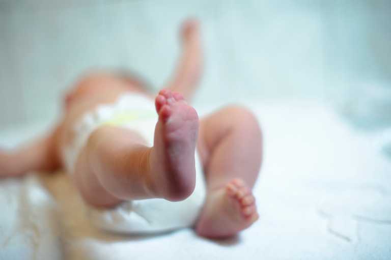 newborn baby feet with cerebral palsy birth injury